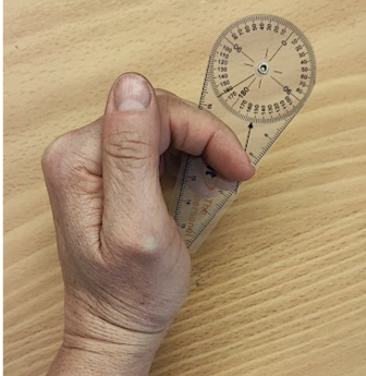 Fingerkuppen-Hohlhandabstand (FKHA)